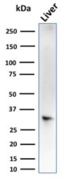 Cytosolic Sulfotransferase 1E1/SULT1E1 Antibody (CPTC-SULT1E1-1) - Azide and BSA Free, Novus Biologicals 100 &mu;g | Buy Online | Novus Biologicals | Fisher Scientific
